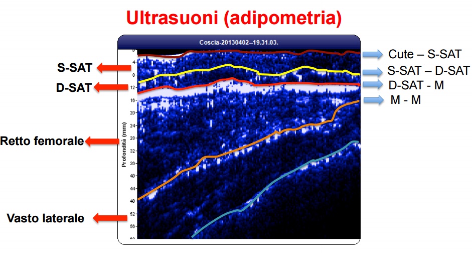 Adipometria - Dott. Marco Ballerini - Terni (Umbria)